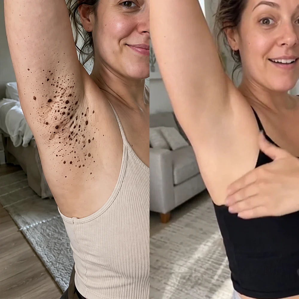 Natravor® 7-𝐃𝐚𝐲 𝐒𝐤𝐢𝐧 𝐓𝐚𝐠 & 𝐒𝐩𝐨𝐭 𝐄𝐫𝐚𝐬𝐞𝐫 𝐂𝐫𝐞𝐚𝐦 (Zero Pain, Zero 𝐒𝐜𝐚𝐫𝐬 Formula) 💎