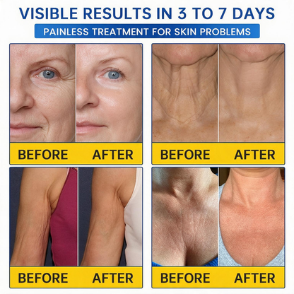 💠🔹🔷🇺🇸 HOT SALE Natravor® PDRN Anti-Wrinkle Shot – Lift & Firming Cream