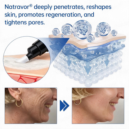 💠🔹🔷🇺🇸 HOT SALE Natravor® PDRN Anti-Wrinkle Shot – Lift & Firming Cream